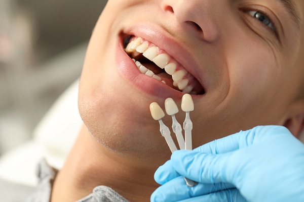 Lumineers® For Gaps Between Teeth