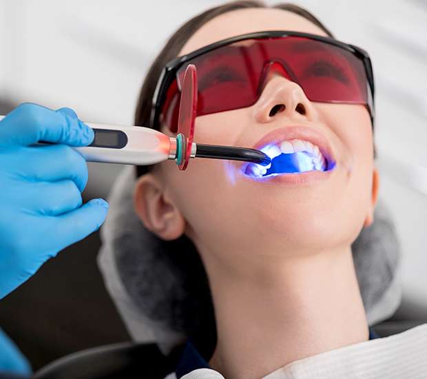 Glendale Professional Teeth Whitening