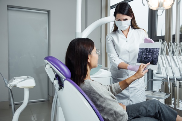 How Tooth Sealants Save Your Natural Teeth